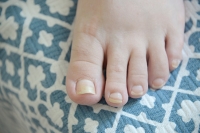 When Toenails Begin to Grow Upward